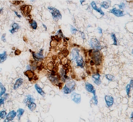 Immunohistochemistry MMP-13 Antibody [Unconjugated]