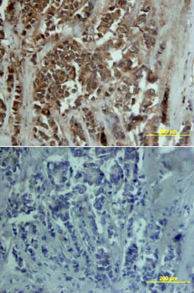 Immunohistochemistry MMP-13 Antibody [Unconjugated]