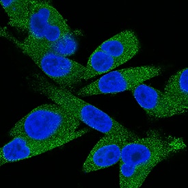 Immunocytochemistry MMP-13 Antibody (87512) [Unconjugated]