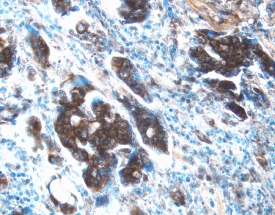 Immunohistochemistry MMP-13 Antibody (87512) [Unconjugated]