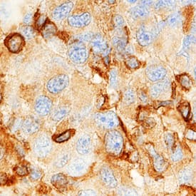 Immunohistochemistry MMP-19 Antibody