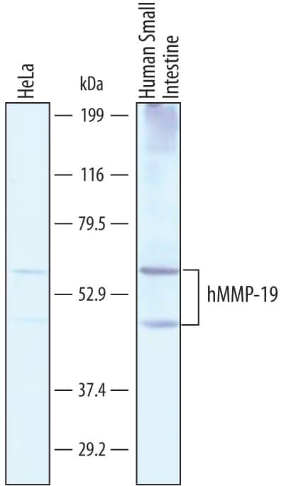 Western Blot MMP-19 Antibody