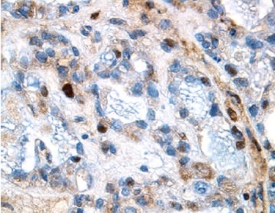 Immunohistochemistry MMP-1 Antibody [Unconjugated]
