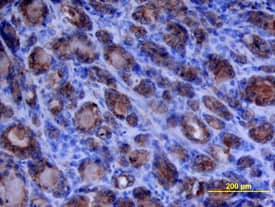 Immunohistochemistry MMP-1 Antibody [Unconjugated]