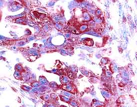 Immunohistochemistry MMP-1 Antibody (36665) [Unconjugated]