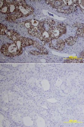 Immunohistochemistry MMP-1 Antibody (36665) [Unconjugated]