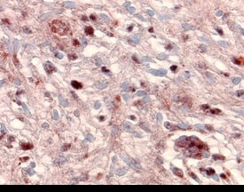 Immunohistochemistry MMP-24/MT5-MMP Antibody [Unconjugated]