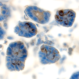 MMP‑7 was detected in perfusion fixed frozen sections of mouse small intestine using Goat Anti-Mouse MMP‑7 Antigen Affinity-purified Polyclonal Antibody (Catalog # AF2967) at 15 &micro;g/mL overnight at 4 &deg;C. Tissue was stained using the Anti-Goat HRP-DAB Cell & Tissue Staining Kit (brown; Catalog # CTS008) and counterstained with hematoxylin (blue). Specific labeling was localized to the cytoplasm of cells in intestinal glands. View our protocol for Chromogenic IHC Staining of Frozen Tissue Sections.