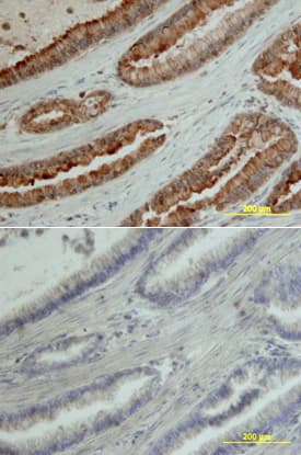 MMP-7 was detected in immersion fixed paraffin-embedded sections of human pancreas array using Goat Anti-Human MMP-7 Antigen Affinity-purified Polyclonal Antibody (Catalog # AF907) at 10 µg/mL overnight at 4 °C. Tissue was stained using the Anti-Goat HRP-DAB Cell & Tissue Staining Kit (brown; Catalog # CTS008) and counterstained with hematoxylin (blue). Lower panel shows a lack of labeling if primary antibodies are omitted and tissue is stained only with secondary antibody followed by incubation with detection reagents. View our protocol for Chromogenic IHC Staining of Paraffin-embedded Tissue Sections.