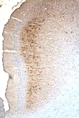 Immunohistochemistry MMP-9 Antibody [Unconjugated]