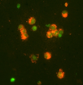Immunocytochemistry MMP-9 Antibody [Unconjugated]