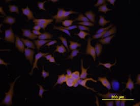 Immunocytochemistry MMP-9 Antibody [Unconjugated]