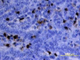 Immunohistochemistry MMP-9 Antibody [Unconjugated]