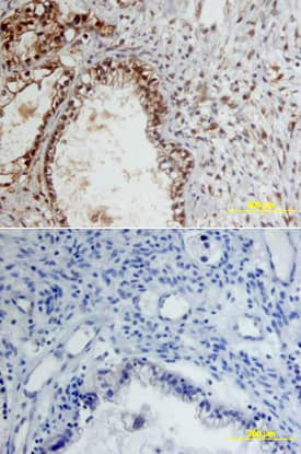 Immunohistochemistry MMP-9 Antibody [Unconjugated]
