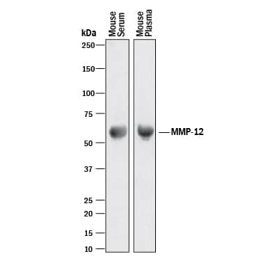 Western blot shows mouse serum and mouse plasma. PVDF membrane was probed with 2 µg/mL of Goat Anti-Mouse MMP-12 Antigen Affinity-purified Polyclonal Antibody (Catalog # AF3467) followed by HRP-conjugated Anti-Goat IgG Secondary Antibody (Catalog # HAF017). A specific band was detected for MMP-12 at approximately 55 kDa (as indicated). This experiment was conducted under reducing conditions and using Immunoblot Buffer Group 1.