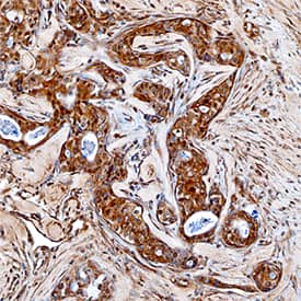 Immunohistochemistry MMP-16/MT3-MMP Antibody [Unconjugated]