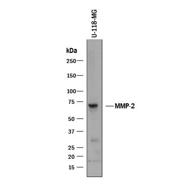 Western blot shows lysate of U-118-MG human glioblastoma/astrocytoma cell line. PVDF membrane was probed with 1 µg/mL of Goat Anti-Human MMP-2 Antigen Affinity-purified Polyclonal Antibody (Catalog # AF902) followed by HRP-conjugated Anti-Goat IgG Secondary Antibody (HAF017). A specific band was detected for MMP-2 at approximately 72 kDa (as indicated). This experiment was conducted under reducing conditions and using Immunoblot Buffer Group 1.