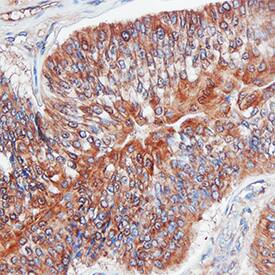 Immunohistochemistry MMP-3 Antibody [Unconjugated]