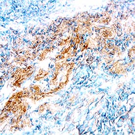 Immunohistochemistry MMP-3 Antibody [Unconjugated]