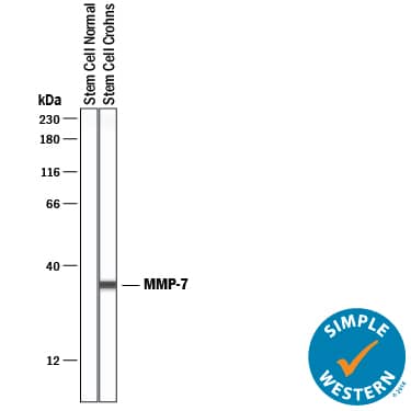 Simple Western lane view shows lysates of normal stem cells (negative control) and Crohn's stem cells, loaded at 0.2 mg/mL. A specific band was detected for MMP-7 at approximately 10 kDa (as indicated) using 10 µg/mL of Goat Anti-Human MMP-7 Antigen Affinity-purified Polyclonal Antibody (Catalog # AF907) followed by 1:50 dilution of HRP-conjugated Anti-Goat IgG Secondary Antibody (HAF109). This experiment was conducted under reducing conditions and using the 12-230 kDa separation system.