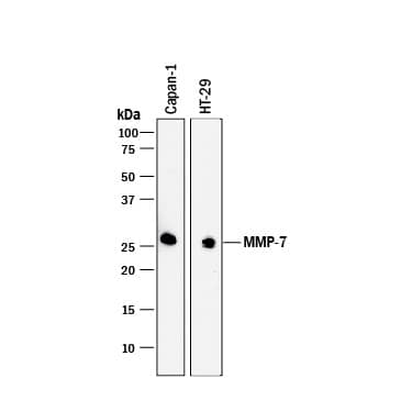 Western blot shows lysates of Capan-1 human pancreatic adenocarcinoma cell line and HT-29 human colon adenocarcinoma cell line. PVDF membrane was probed with 1 µg/mL of Goat Anti-Human MMP-7 Antigen Affinity-purified Polyclonal Antibody (Catalog # AF907) followed by HRP-conjugated Anti-Goat IgG Secondary Antibody (HAF017). A specific band was detected for MMP-7 at approximately 28 kDa (as indicated). This experiment was conducted under reducing conditions and using Immunoblot Buffer Group 1.