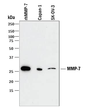 Western blot shows lysates of Capan-1 human pancreatic adenocarcinoma cell line and SK-OV-3 human ovarian adenocarcinoma cell line and, for additional reference, Recombinant Human MMP-7 Western Blot Standard Protein (Catalog # WBC016). PVDF membrane was probed with 1 µg/mL of Mouse Anti-Human MMP-7 Monoclonal Antibody (Catalog # MAB9071) followed by HRP-conjugated Anti-Mouse IgG Secondary Antibody (Catalog # HAF018). A specific band was detected for MMP-7 at approximately 28 kDa (as indicated). This experiment was conducted under reducing conditions and using Immunoblot Buffer Group 1.