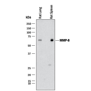 Western blot shows lysates of rat lung tissue and rat spleen tissue. PVDF membrane was probed with 0.5 µg/mL of Goat Anti-Mouse/Rat MMP-8 Antigen Affinity-purified Polyclonal Antibody (Catalog # AF3245) followed by HRP-conjugated Anti-Goat IgG Secondary Antibody (Catalog # HAF017). A specific band was detected for MMP-8 at approximately 53 kDa (as indicated). This experiment was conducted under reducing conditions and using Immunoblot Buffer Group 1.