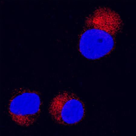 MMP-8 was detected in immersion fixed Jurkat human acute T cell leukemia cell line using Goat Anti-Human MMP-8 Antigen Affinity-purified Polyclonal Antibody (Catalog # AF908) at 15 µg/mL for 3 hours at room temperature. Cells were stained using the NorthernLights™ 557-conjugated Anti-Goat IgG Secondary Antibody (red; Catalog # NL001) and counterstained with DAPI(blue). Specific staining was localized to cytoplasm. View our protocol for Fluorescent ICC Staining of Cells on Coverslips.