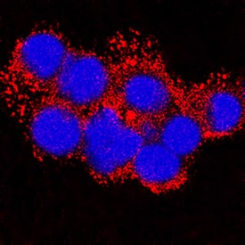 Immunocytochemistry MMP-9 Antibody [Unconjugated]