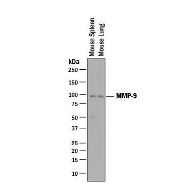 Western Blot MMP-9 Antibody [Unconjugated]