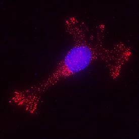 MMP-9 was detected in immersion fixed SW1353 human chondrosarcoma cell line using Mouse Anti-Human/Primate MMP-9 Monoclonal Antibody (Catalog # MAB936) at 3 µg/mL for 3 hours at room temperature. Cells were stained using the NorthernLights™ 557-conjugated Anti-Mouse IgG Secondary Antibody (red; Catalog # NL007) and counterstained with DAPI (blue). Specific staining was localized to cytoplasm. View our protocol for Fluorescent ICC Staining of Cells on Coverslips.