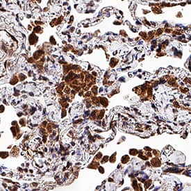 MMP-9 was detected in immersion fixed paraffin-embedded sections of human lung using Mouse Anti-Human/Primate MMP-9 Monoclonal Antibody (Catalog # MAB936) at 15 µg/mL for 1 hour at room temperature followed by incubation with the Anti-Mouse IgG VisUCyte™ HRP Polymer Antibody (Catalog # VC001). Tissue was stained using DAB (brown) and counterstained with hematoxylin (blue). Specific staining was localized to cytoplasm in macrophages. View our protocol for IHC Staining with VisUCyte HRP Polymer Detection Reagents.