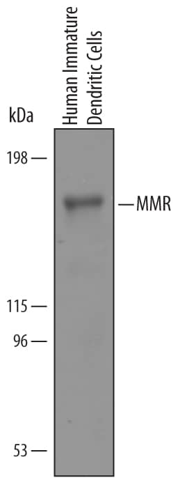 Western Blot MMR/CD206/Mannose Receptor Antibody [Unconjugated]