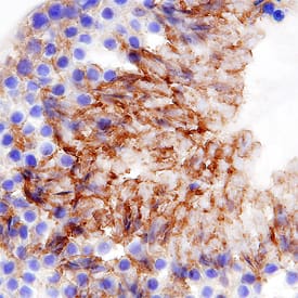 MMR/CD206 was detected in perfusion fixed frozen sections of mouse testis using Goat Anti-Mouse MMR/CD206 Antigen Affinity-purified Polyclonal Antibody (Catalog # AF2535) at 5 µg/mL overnight at 4 °C. Tissue was stained using the Anti-Goat HRP-DAB Cell & Tissue Staining Kit (brown; Catalog # CTS008) and counterstained with hematoxylin (blue). Specific staining was localized to spermatocytes in testis. View our protocol for Chromogenic IHC Staining of Frozen Tissue Sections.