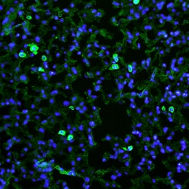 MMR/CD206 was detected in perfusion fixed frozen sections of mouse lung using Goat Anti-Mouse MMR/CD206 Antigen Affinity-purified Polyclonal Antibody (Catalog # AF2535) at 25 µg/mL overnight at 4 °C. Tissue was stained using the NorthernLights™ 493-conjugated Anti-Goat IgG Secondary Antibody (green; Catalog # NL003) and counterstained with DAPI (blue). Specific staining was localized to cytoplasm of macrophages. View our protocol for Fluorescent IHC Staining of Frozen Tissue Sections.