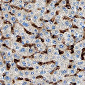 MMR/CD206 was detected in immersion fixed paraffin-embedded sections of human liver using Mouse Anti-Human MMR/CD206 Monoclonal Antibody (Catalog # MAB25341) at 15 µg/mL overnight at 4 °C. Before incubation with the primary antibody, tissue was subjected to heat-induced epitope retrieval using Antigen Retrieval Reagent-Basic (Catalog # CTS013). Tissue was stained using the Anti-Mouse HRP-DAB Cell & Tissue Staining Kit (brown; Catalog # CTS002) and counterstained with hematoxylin (blue). Specific staining was localized to endothelial cells in sinusoids. View our protocol for Chromogenic IHC Staining of Paraffin-embedded Tissue Sections.