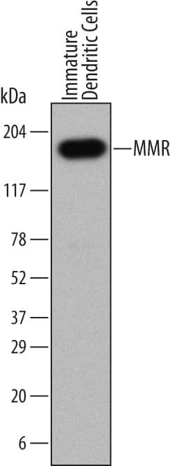 Western blot shows lysates of human immature dendritic cells. PVDF Membrane was probed with 1 µg/mL of Mouse Anti-Human MMR/CD206 Monoclonal Antibody (Catalog # MAB25341) followed by HRP-conjugated Anti-Mouse IgG Secondary Antibody (Catalog # HAF007). A specific band was detected for MMR/CD206 at approximately 150 kDa (as indicated). This experiment was conducted under reducing conditions and using Immunoblot Buffer Group 1.
