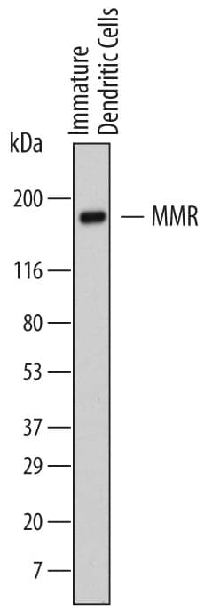 Western blot shows lysates of human immature dendritic cells. PVDF membrane was probed with 2 µg/mL of Mouse Anti-Human MMR/CD206 Monoclonal Antibody (Catalog # MAB25342) followed by HRP-conjugated Anti-Mouse IgG Secondary Antibody (Catalog # HAF007). A specific band was detected for MMR/CD206 at approximately 170 kDa (as indicated). This experiment was conducted under reducing conditions and using Immunoblot Buffer Group 1.