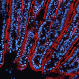 Immunohistochemistry MR1 Antibody (909417) [Unconjugated]