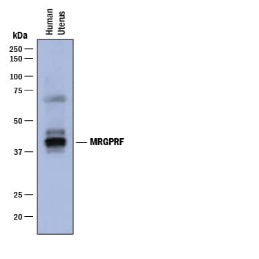 Western Blot MRGPRF Antibody (916219) [Unconjugated]