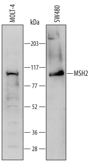 Western blot shows lysates of MOLT-4 human acute lymphoblastic leukemia cell line and SW480 human colorectal adenocarcinoma cell line. PVDF Membrane was probed with 2 µg/mL of Sheep Anti-Human MSH2 Antigen Affinity-purified Polyclonal Antibody (Catalog # AF6780) followed by HRP-conjugated Anti-Sheep IgG Secondary Antibody (Catalog # HAF016). A specific band was detected for MSH2 at approximately 100 kDa (as indicated). This experiment was conducted under reducing conditions and using Immunoblot Buffer Group 1.