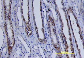Immunohistochemistry MSK1/RPS6KA5 [p Ser212] Antibody [Unconjugated]
