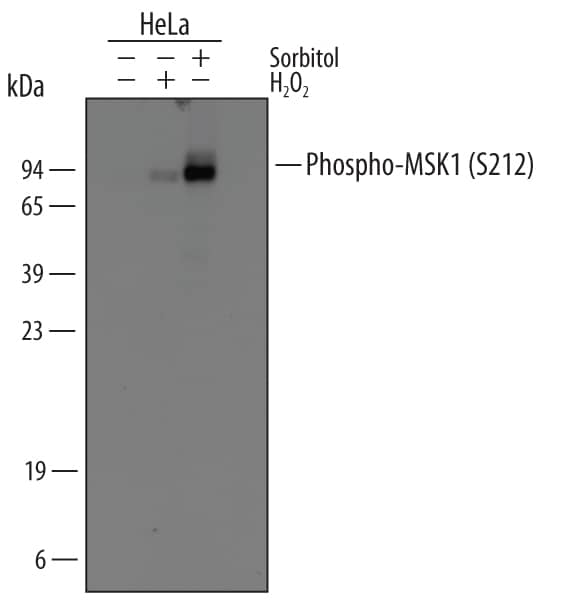 Western Blot MSK1/RPS6KA5 [p Ser212] Antibody [Unconjugated]