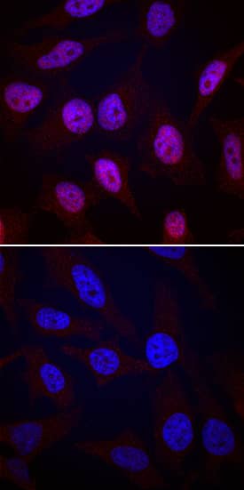 MSK1/2 phosphorylated at S376/S360 was detected in immersion fixed HeLa human cervical epithelial carcinoma cell line stimulated (top panel), or unstimulated (bottom panel), with 200 ng/mL Recombinant Human EGF (Catalog # 236-EG) using Rabbit Anti-Human MSK1/2 Monoclonal Antibody (Catalog # MAB25181) at 10 µg/mL for 3 hours at room temperature. Cells were stained using the NorthernLights™ 557-conjugated Anti-Rabbit IgG Secondary Antibody (red; Catalog # NL004) and counterstained with DAPI (blue). Specific staining was localized to nuclei. View our protocol for Fluorescent ICC Staining of Cells on Coverslips.