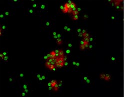 MSK1 was detected in immersion fixed human lymphocytes using 8 &micro;g/mL Human MSK1 Monoclonal Antibody (Catalog # MAB2518) for 3 hours at room temperature. Cells were stained (red) and counterstained (green). View our protocol for Fluorescent ICC Staining of Non-adherent Cells.