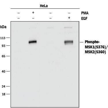 Western blot shows lysates of HeLa human cervical epithelial carcinoma cell line untreated (-) or treated (+) with 200 nM PMA for 20 minutes and 100 ng/mL Recombinant Human EGF (Catalog # 236-EG) for 5 minutes. PVDF membrane was probed with 0.1 µg/mL of Rabbit Anti-Human Phospho-MSK1/MSK2 (MSK1 S376, MSK2 S360) Monoclonal Antibody (Catalog # MAB1094) followed by HRP-conjugated Anti-Rabbit IgG Secondary Antibody (Catalog # HAF008). A specific band was detected for Phospho-MSK1 (S376)/MSK2 (S360) at approximately 95 kDa (as indicated). This experiment was conducted under reducing conditions and using Immunoblot Buffer Group 1.