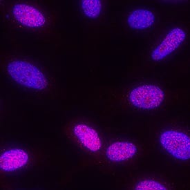 MSK1/2 phosphorylated at S376/S360 was detected in immersion fixed HeLa human cervical epithelial carcinoma cell line treated with PMA using Rabbit Anti-Human MSK1/MSK2 Monoclonal Antibody (Catalog # MAB25181) at 1 µg/mL for 3 hours at room temperature. Cells were stained using the NorthernLights™ 557-conjugated Anti-Rabbit IgG Secondary Antibody (red; Catalog # NL004) and counterstained with DAPI (blue). Specific staining was localized to nuclei. View our protocol for Fluorescent ICC Staining of Cells on Coverslips.