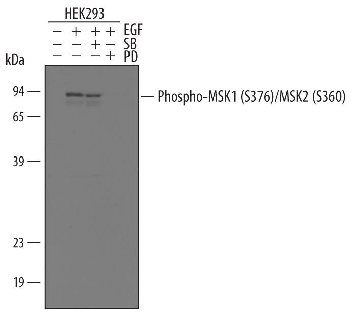 Western blot shows lysates of HEK293 human embryonic kidney cell line untreated (-) or treated (+) with 200 ng/mL Recombinant Human EGF (Catalog # 236-EG) in the presence or absence of pathway inhibitors SB203580 and PD98059 for 20 minutes. PVDF membrane was probed with 0.2 µg/mL of Rabbit Anti-Human Phospho-MSK1/MSK2 (MSK1 S376, MSK2 S360) Antigen Affinity-purified Polyclonal Antibody, followed by HRP-conjugated Anti-Rabbit IgG Secondary Antibody (Catalog # HAF008). A specific band was detected for Phospho-MSK1/MSK2 (MSK1 S376, MSK2 S360) at approximately 90 kDa (as indicated). This experiment was conducted under reducing conditions and using Immunoblot Buffer Group 1.
