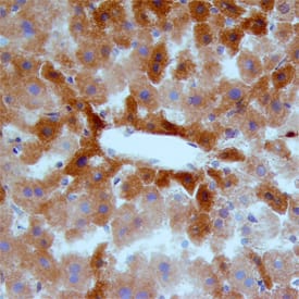 MSP/MST1 was detected in perfusion fixed frozen sections of mouse liver using Sheep Anti-Mouse MSP/MST1 Antigen Affinity-purified Polyclonal Antibody (Catalog # AF6244) at 15 µg/mL overnight at 4 °C. Tissue was stained using the Anti-Sheep HRP-DAB Cell & Tissue Staining Kit (brown; Catalog # CTS019) and counterstained with hematoxylin (blue). Specific staining was localized to hepatocytes. View our protocol for Chromogenic IHC Staining of Frozen Tissue Sections.