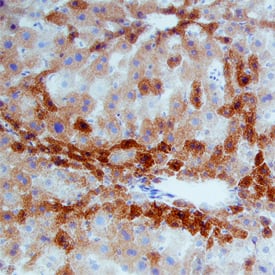 MSP/MST1 was detected in perfusion fixed frozen sections of mouse liver using Rat Anti-Mouse MSP/MST1 Monoclonal Antibody (Catalog # MAB6244) at 25 µg/mL overnight at 4 °C. Tissue was stained using the Anti-Rat HRP-DAB Cell & Tissue Staining Kit (brown; Catalog # CTS017) and counterstained with hematoxylin (blue). Specific staining was localized to hepatocytes. View our protocol for Chromogenic IHC Staining of Frozen Tissue Sections.